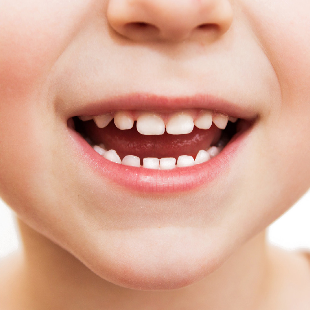 Dolcetto o scherzetto? Gli effetti dello zucchero sui denti dei bambini 